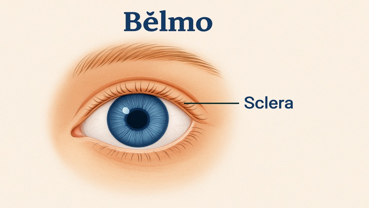 Bělmo: Understanding Corneal Opacity, Its Causes, Symptoms, and Treatment 41 Bělmo