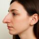 Hook Nose: Features, Causes, and How to Embrace or Modify It 50 Hook Nose