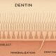 Understanding Dentinas: Structure, Function, and Importance in Oral Health 46 Dentinas