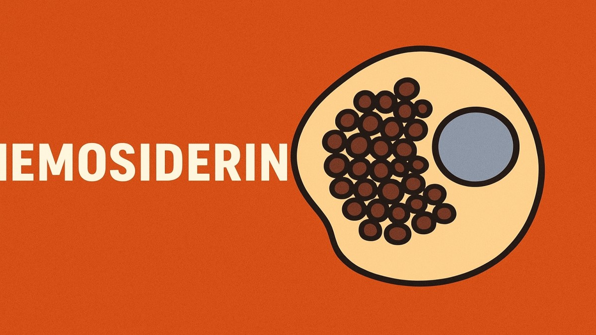 Hemosiderin: Understanding Its Role, Causes & Health Implications 41 Hemosiderin