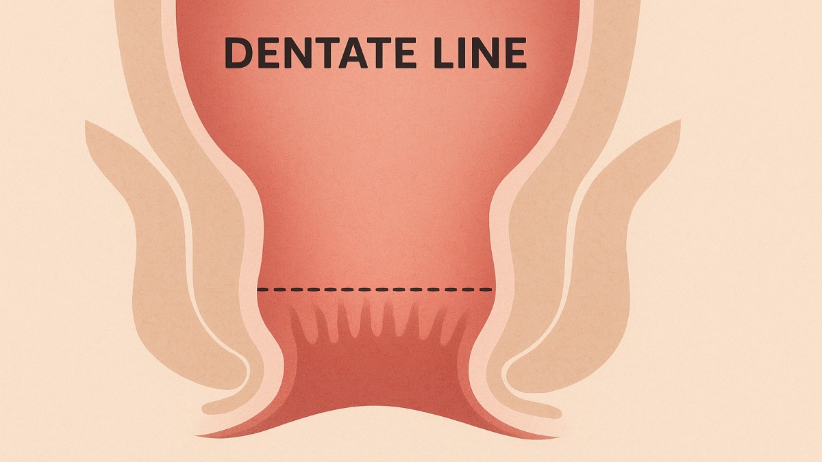 The Dentate Line – A Complete Anatomical and Clinical Guide 41 Dentate Line