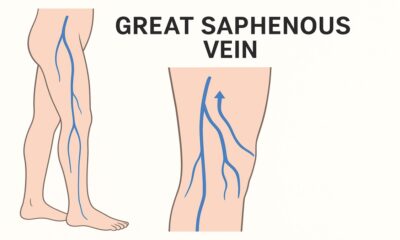The Great Saphenous Vein: Anatomy, Function, and Clinical Significance 49 Great Saphenous Vein