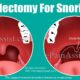 Uvulectomy: Procedure, Benefits, Risks & Complete Guide 52 Uvulectomy