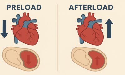 Preload vs Afterload