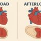Preload vs Afterload: Understanding the Heart’s Hidden Forces 53 Preload vs Afterload