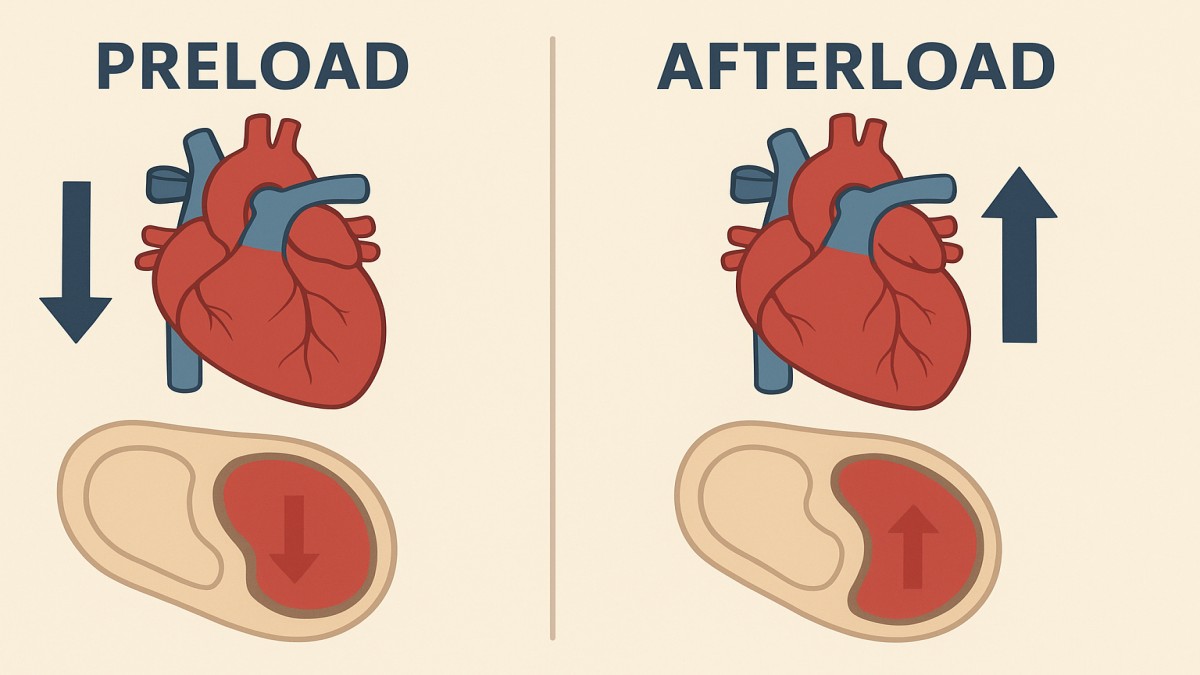 Preload vs Afterload: Understanding the Heart’s Hidden Forces 41 Preload vs Afterload