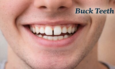 Buck Teeth